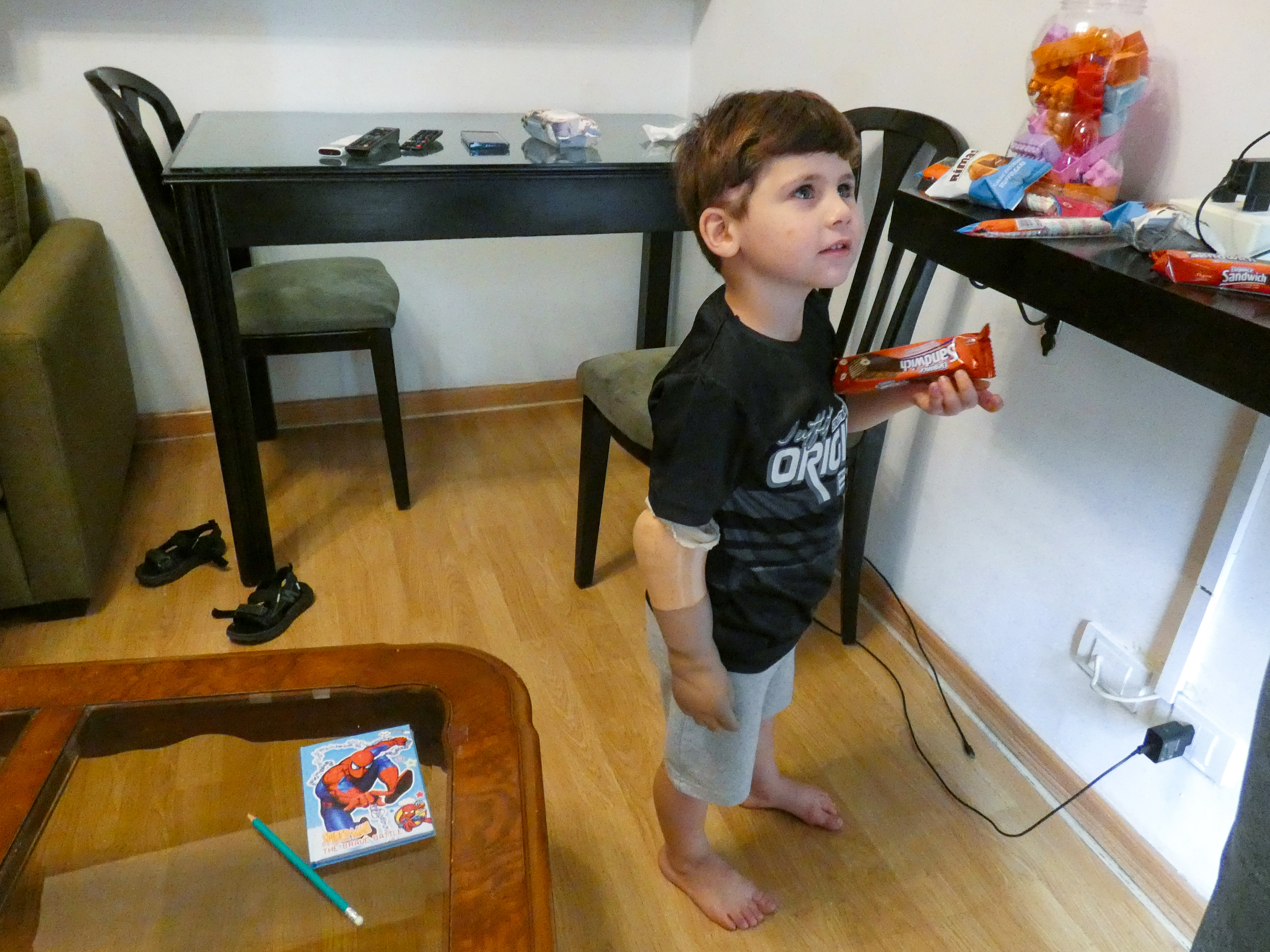 Ali is standing, holding a sweet snack in his left hand. His right arm was amputated, but he has a prosthetic, which he is wearing. He is barefoot, standing and looking up at someone off to the right of the frame
