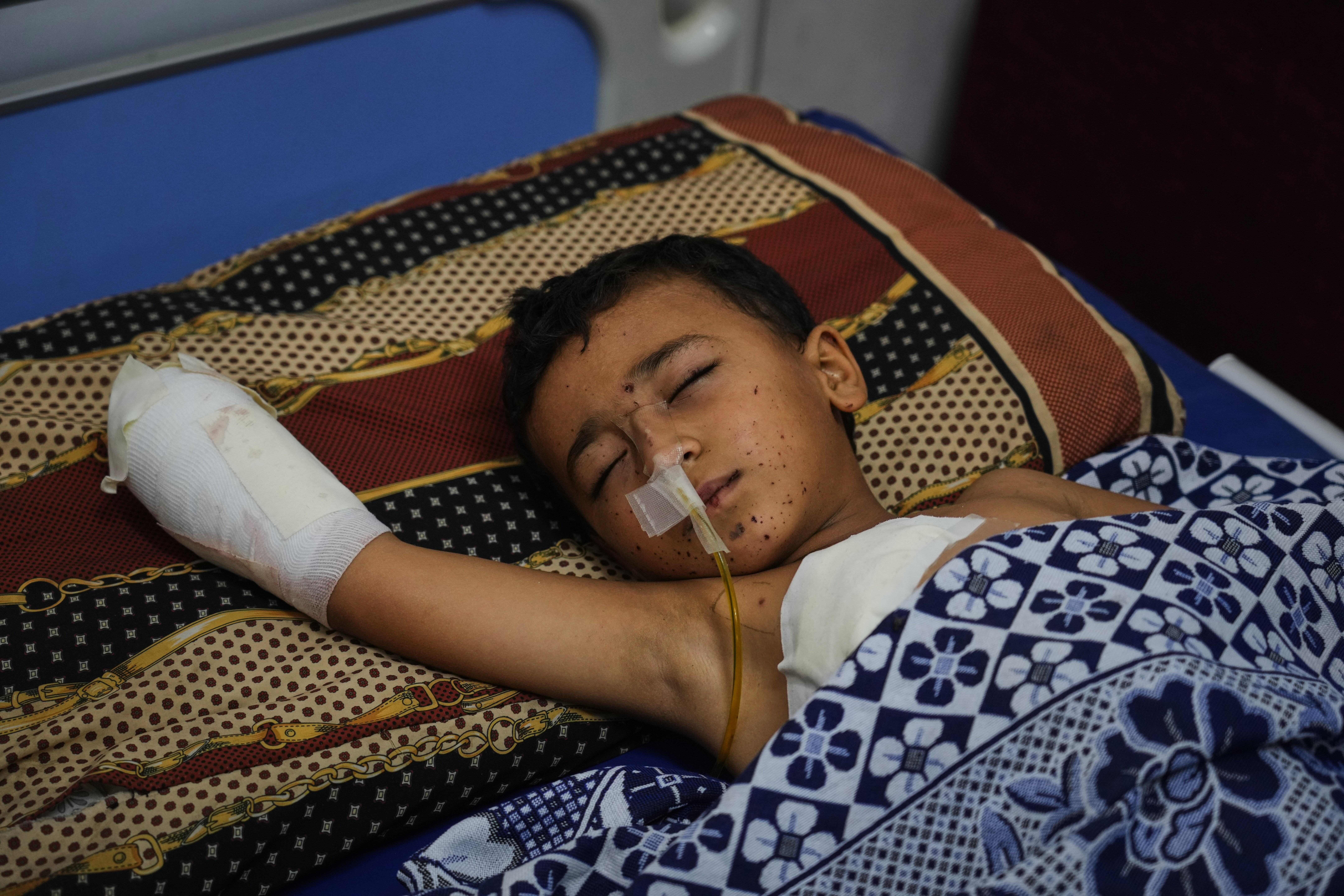 Yahya Shorbasi, who was injured by an unexploded ordnance along with his six-year-old twin sister Nabila, lies on a bed at Shifa Hospital in Gaza City, Saturday, Oct. 25, 2025. (AP Photo/Abdel Kareem Hana)