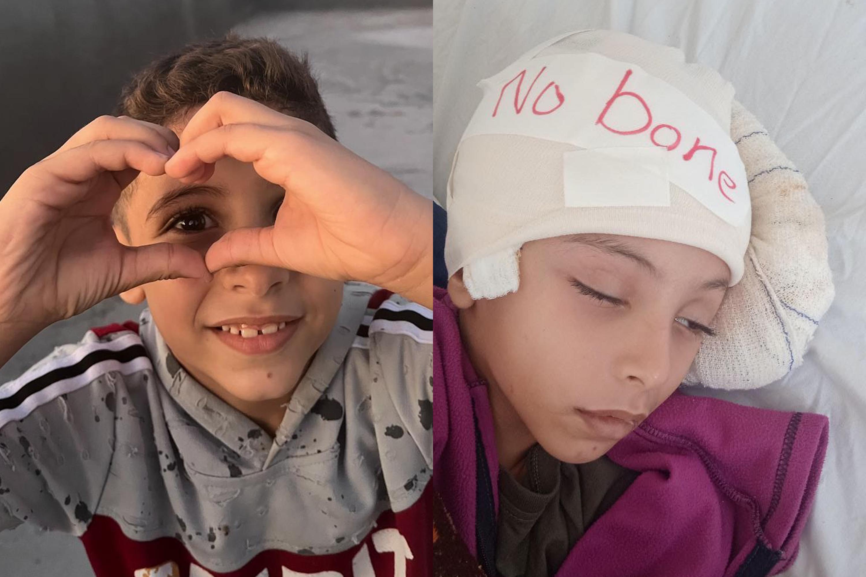 A collage of two photos of a boy; one of him making a heart with his hands and another of him with a bandaged head.