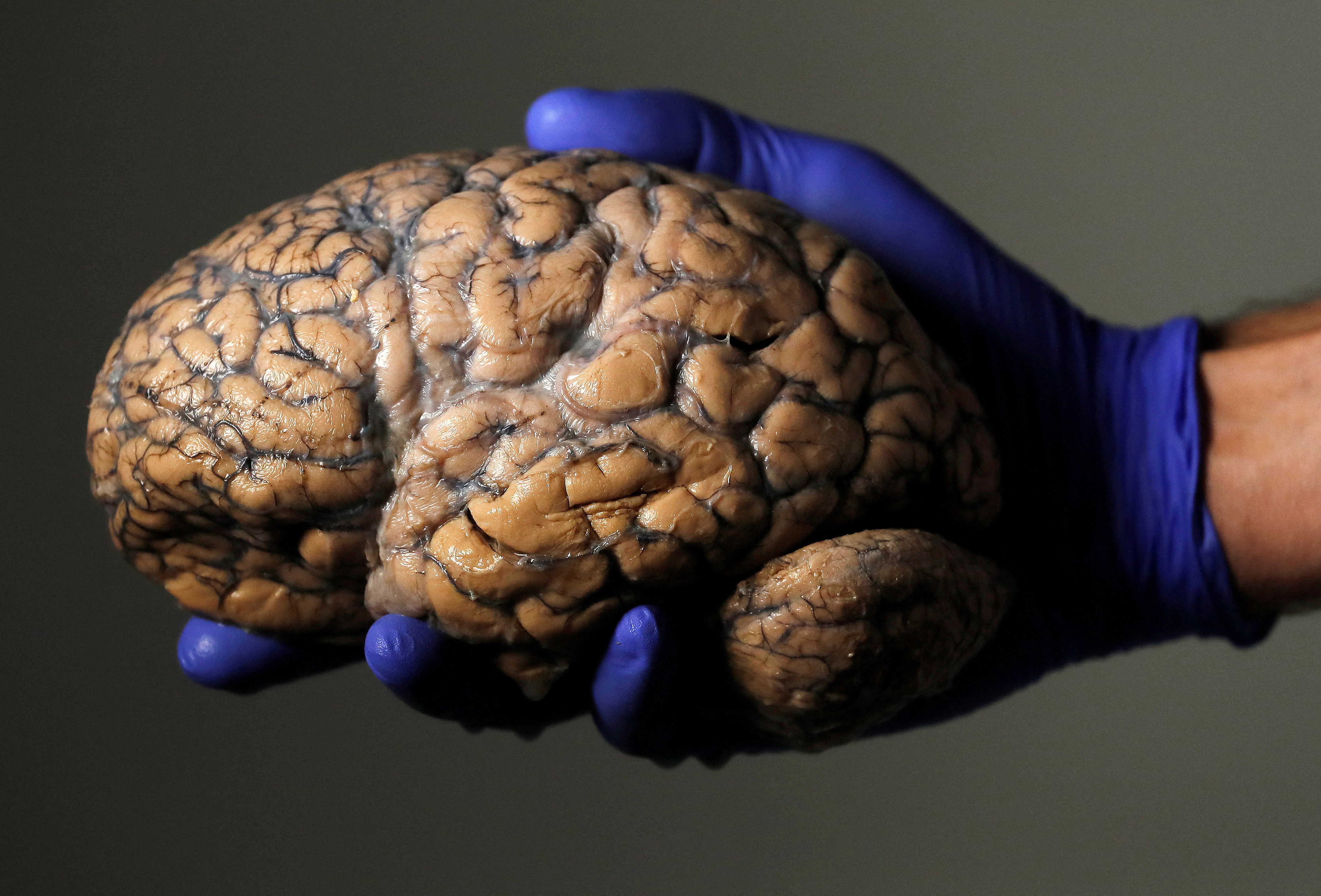 FILE PHOTO: A researcher holds a human brain, part of a collection of more than 3,000 brains at the psychiatric hospital in Duffel, Belgium, July 19, 2017. REUTERS/Yves Herman/File Photo