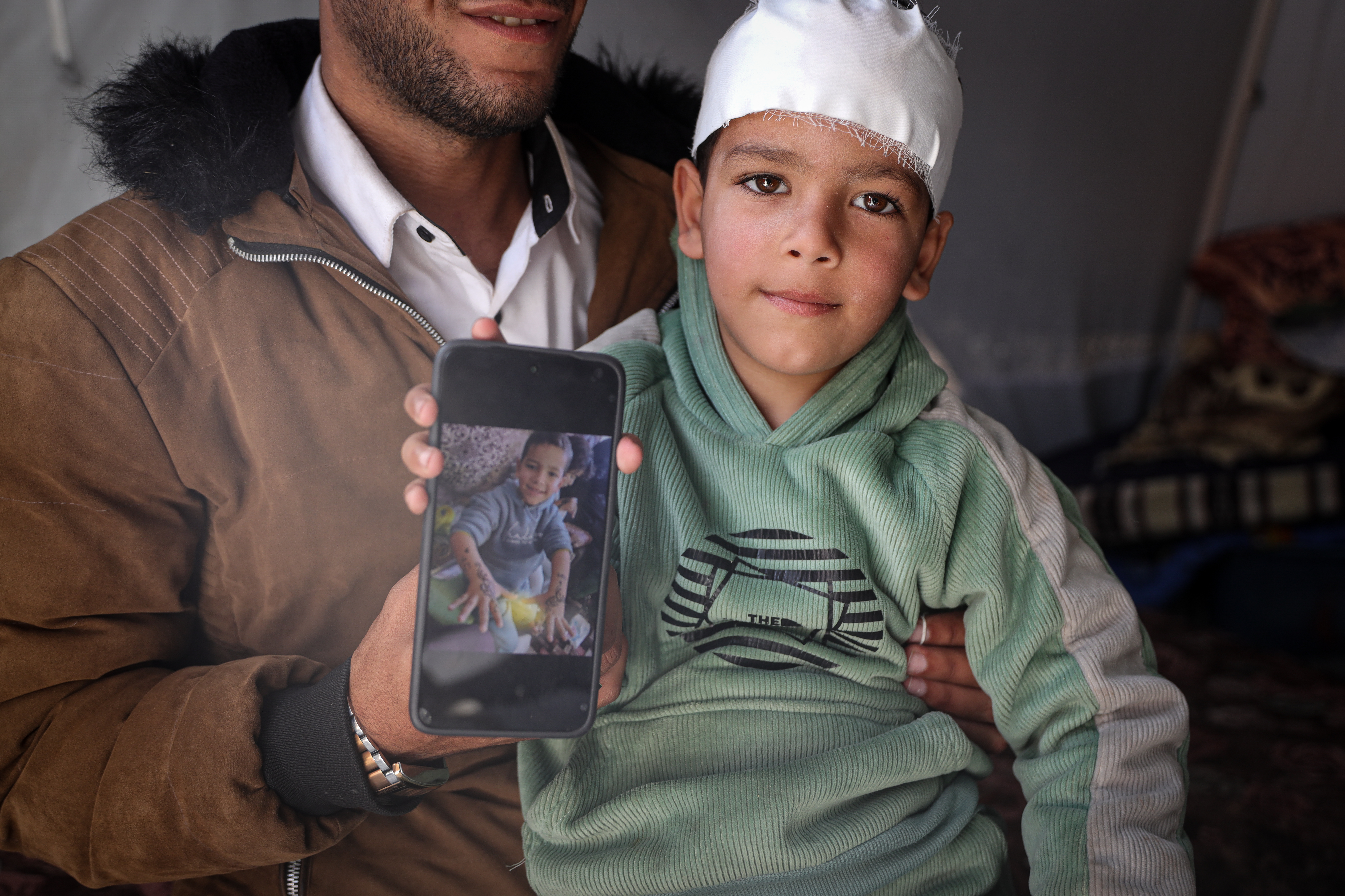 Youssef, 7, with a bandage around his head, holds a mobile phone showing an image of him before his injury