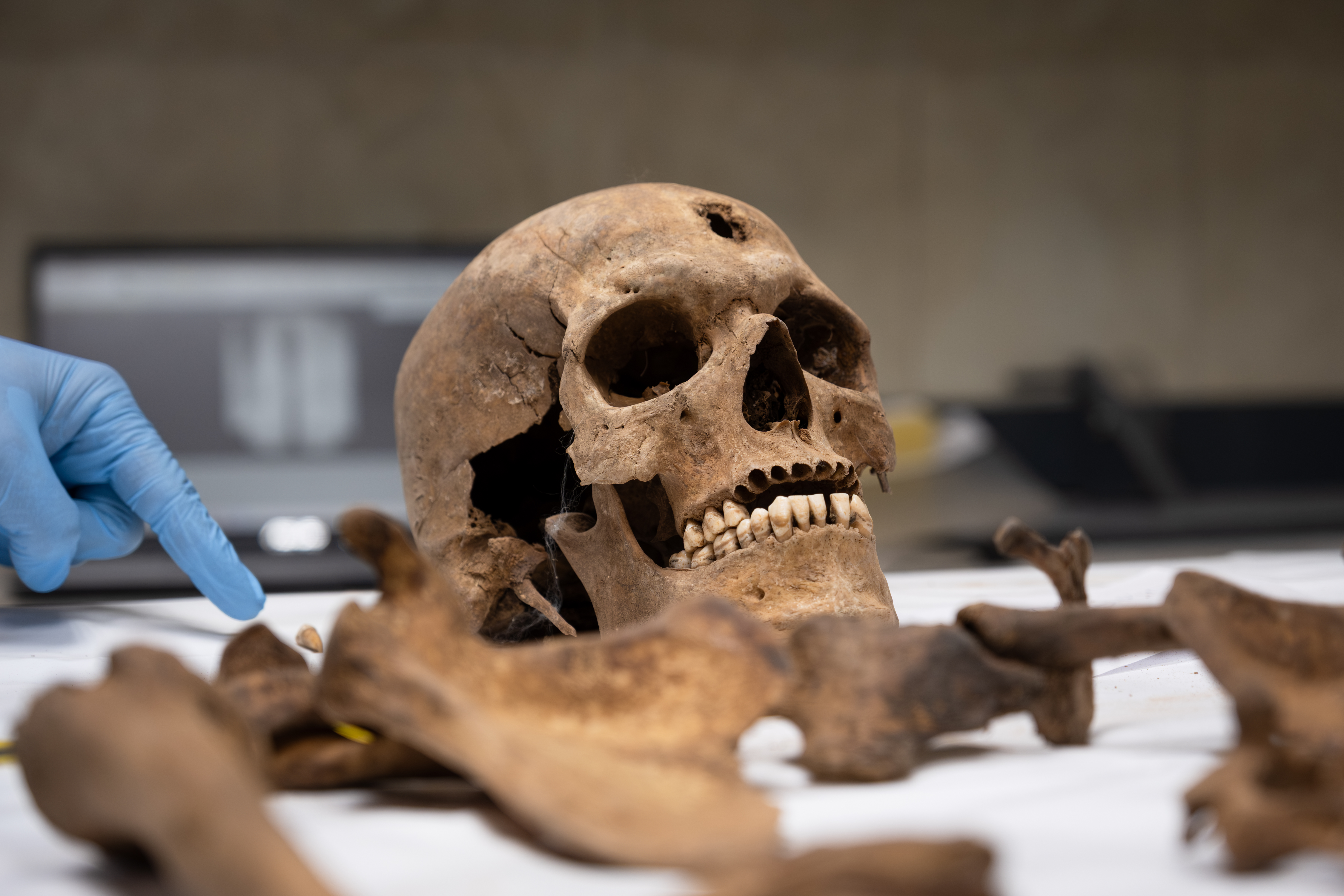  It’s believed this victim died from a gunshot to the head. [Harriet Tatham/Al Jazeera]