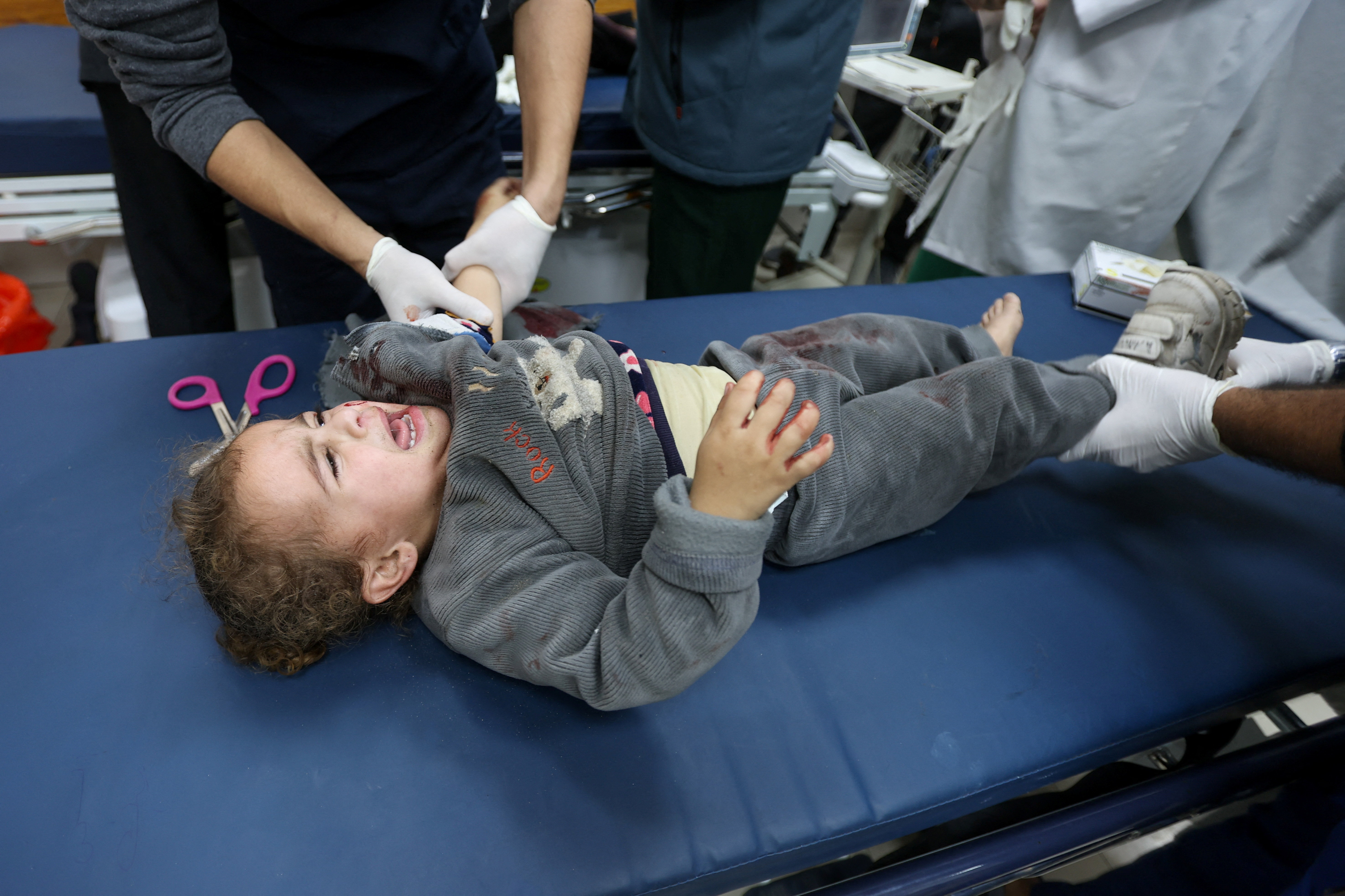 A Palestinian child wounded in an Israeli air strike, according to medics, receives medical treatment at Nasser Hospital, in Khan Younis, southern Gaza Strip, January 5, 2026.