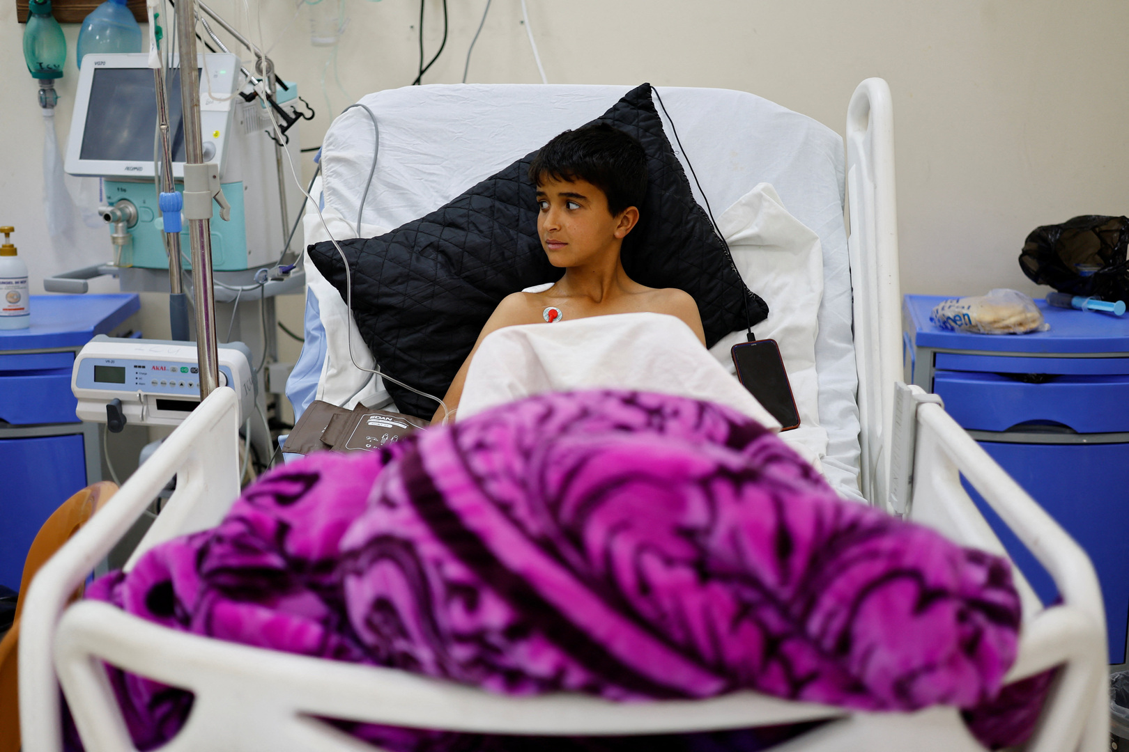 A Palestinian boy lies on a hospital bed receiving treatment for burn injuries at a Doctors Without Borders (MSF) hospital, amid severe shortages of medical equipment, medicines and essential materials needed for burn treatment, in Zawaida in the central Gaza Strip on Jan. 26, 2026. [Mahmoud Issa/Reuters]
