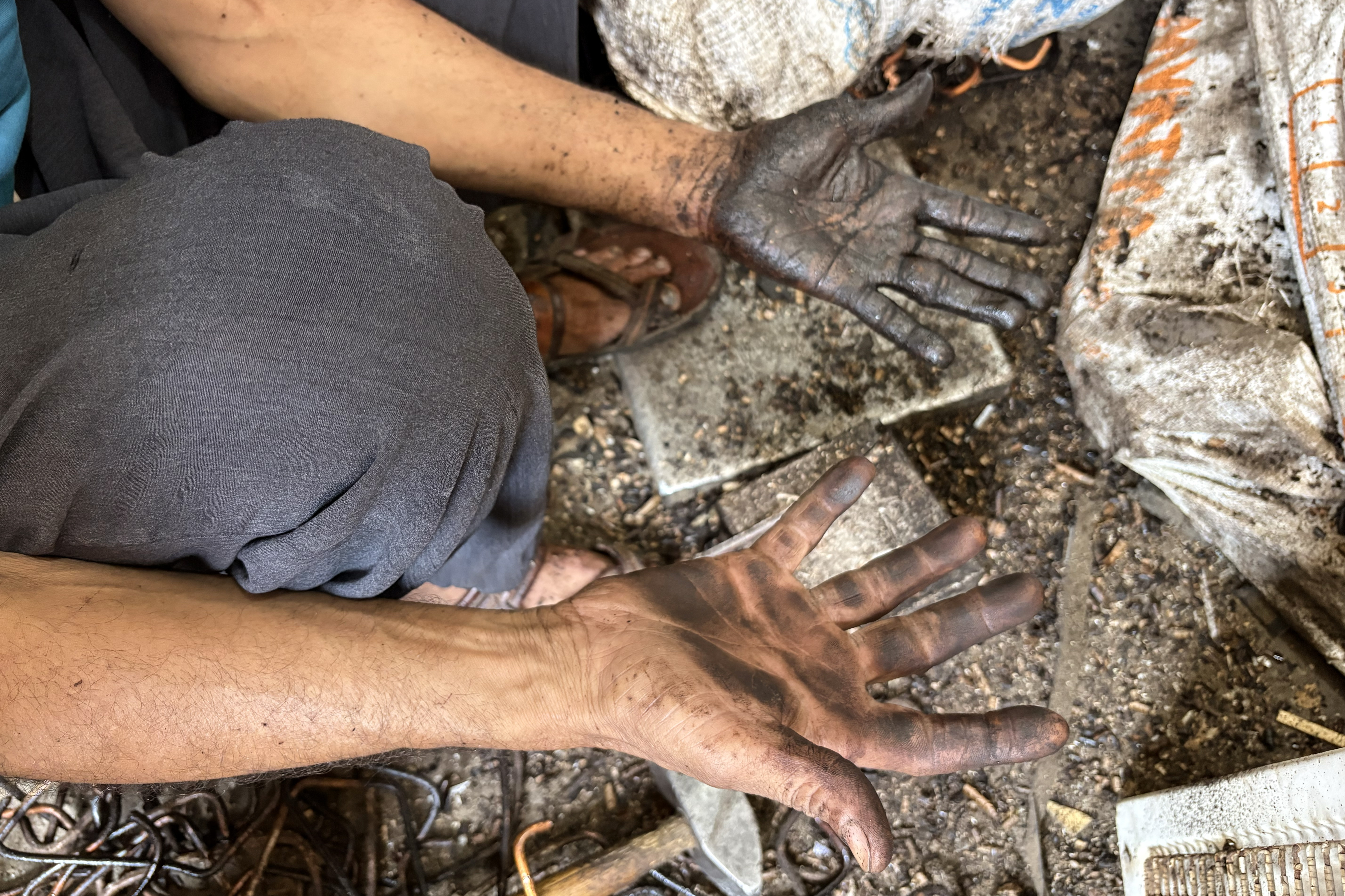 A worker shows his stained hands from separating the waste. He says the work exposes him to fumes and frequently causes cuts and infections