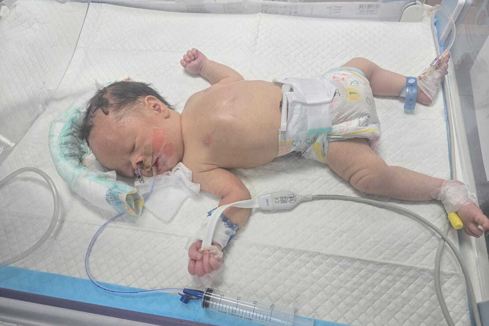 Baby Saleh Faqih, born prematurely after his mother slipped and went into labour during the settler attack, continues to fight for his life in a Ramallah intensive care unit [Courtesy of the Faqih family]
