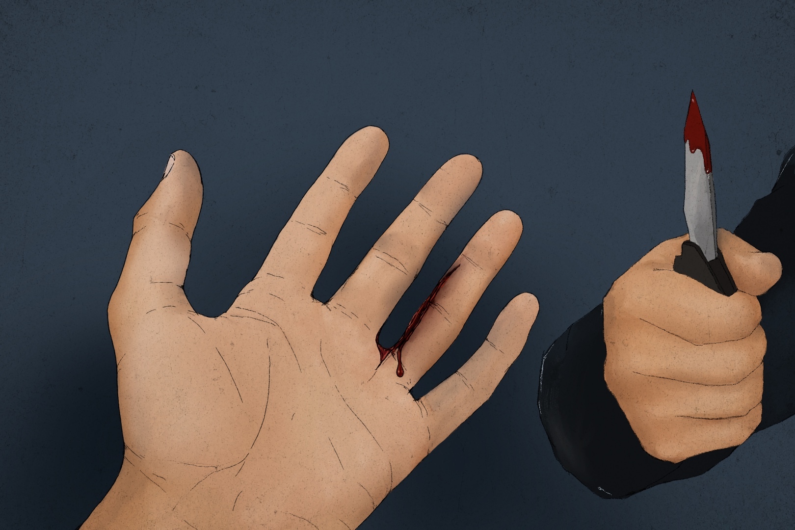 The injured hand of a flotilla activist after an encounter at the processing centre of the Israeli port of Ashdod