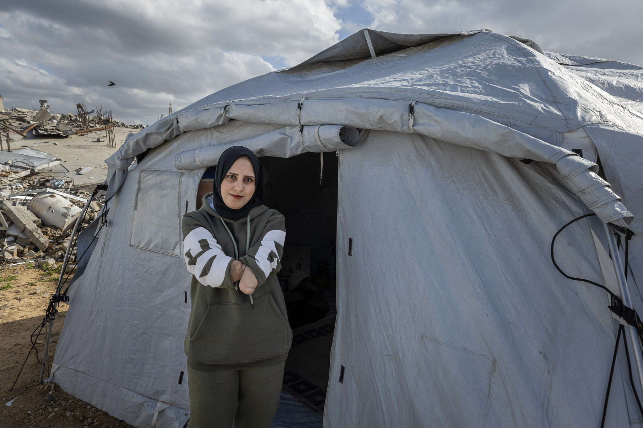 “I wish I could hold my daughter, feed her, and dress her like all mothers in the world do,” says Nibal al-Hissi. A young mother of one, Nibal lost both arms after a shell strike. She now lives in a tent at a displacement site in eastern Gaza, where even the simplest things like feeding herself, dressing, and caring for her child have become daily struggle