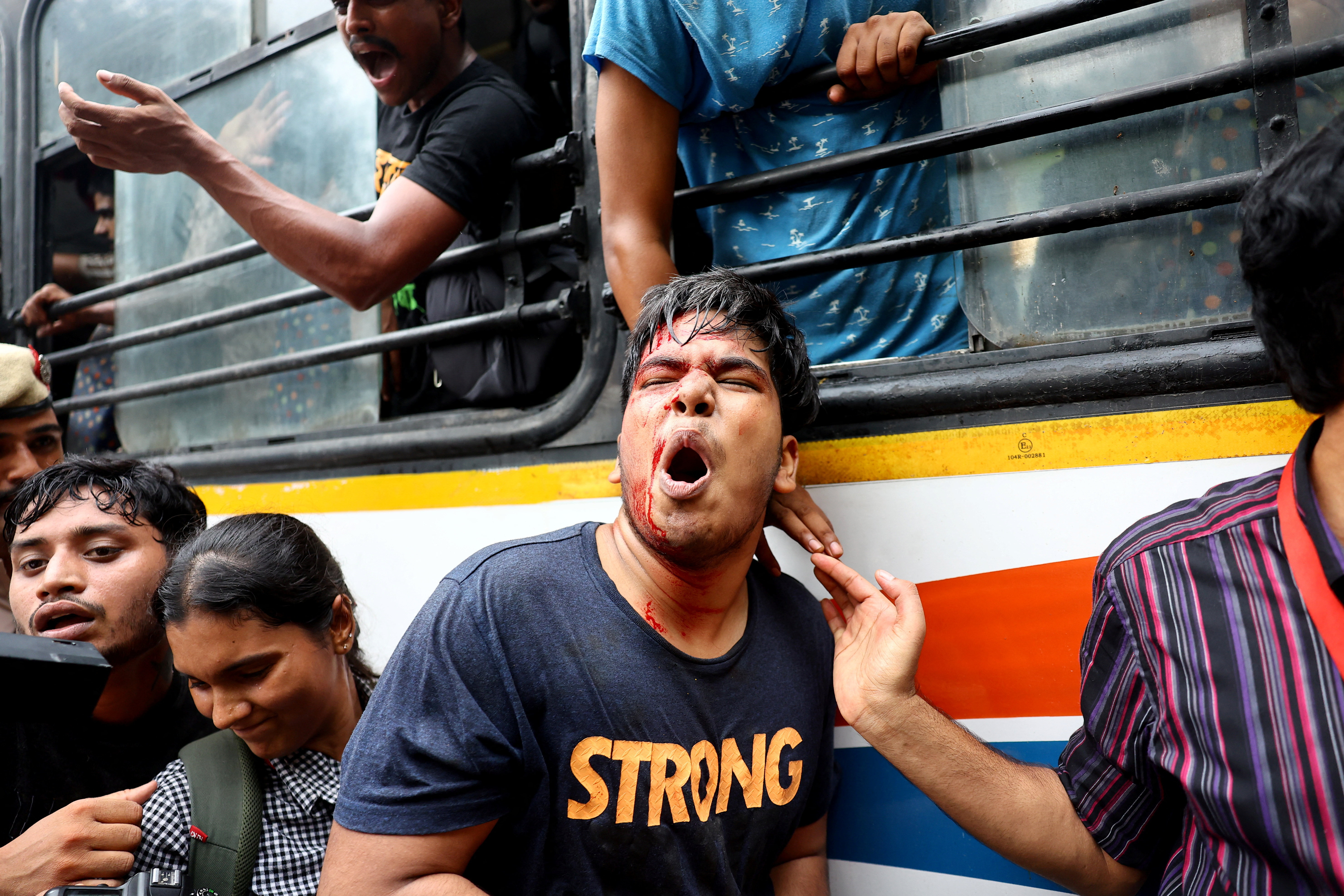 An injured demonstrator during a march to demand the resignation of India’s education minister