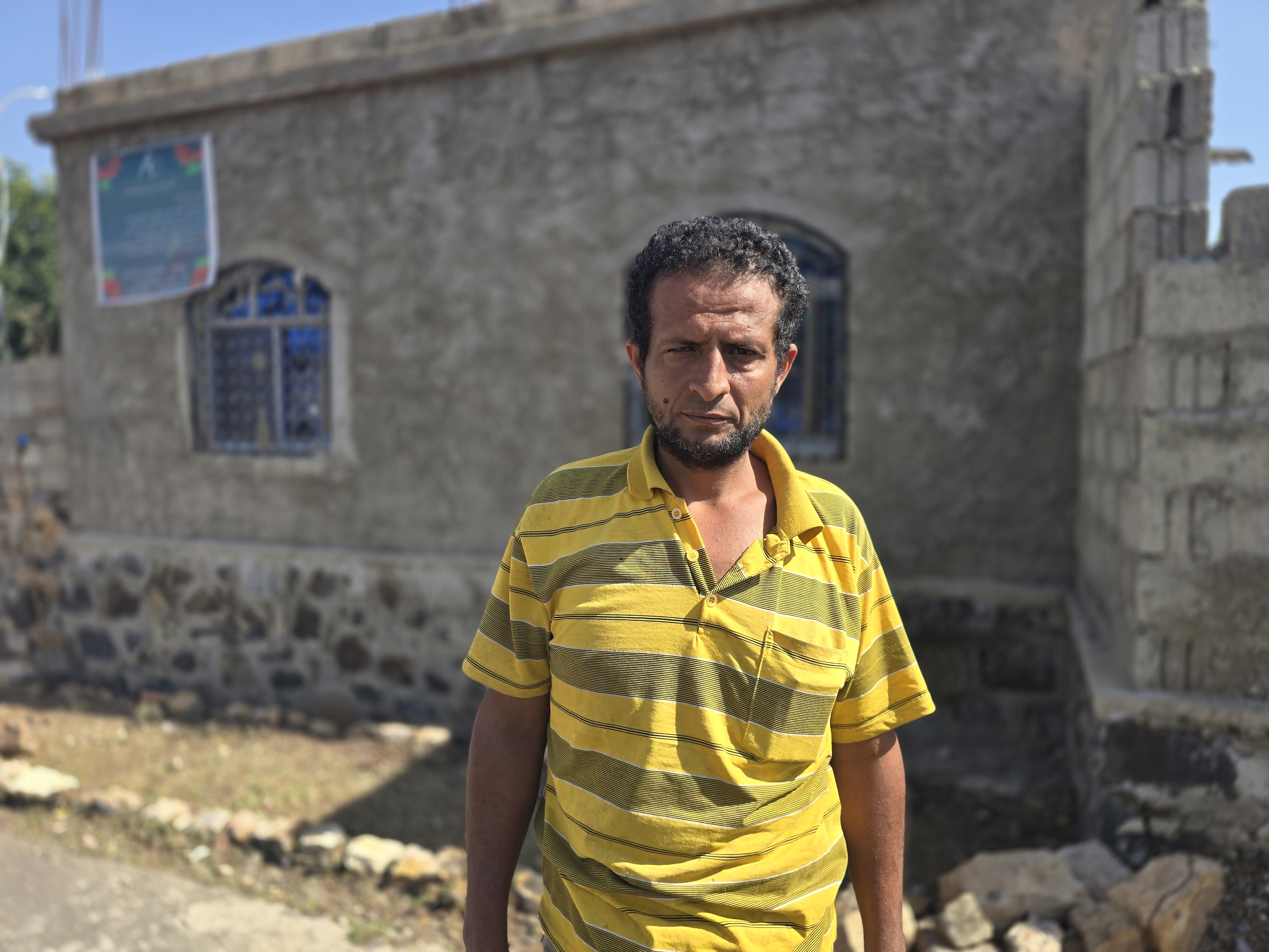 Taha Nabil, 45, who completely lost sight in his right eye, risks going entirely blind if he cannot access the medical care he needs [Nasser al-Sakkaf/Al Jazeera]
