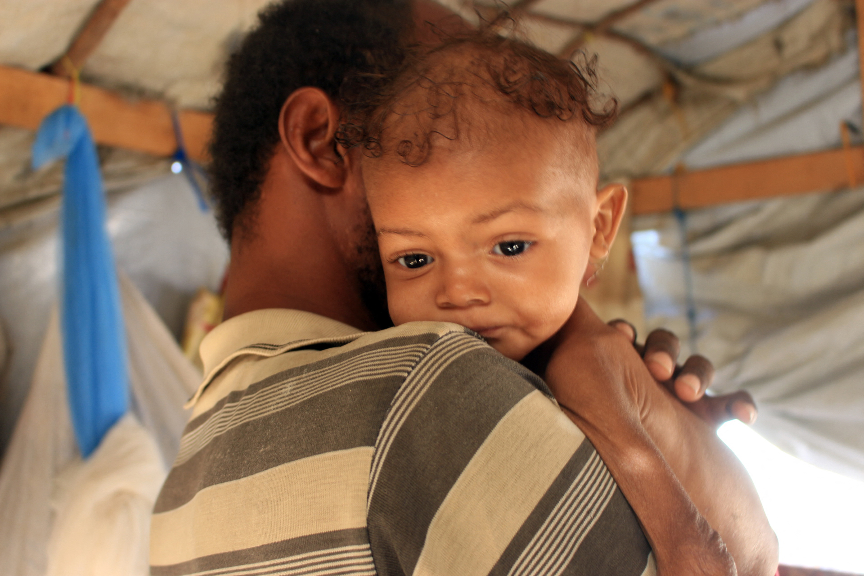 Three-year-old Yemeni child Randa Ali, suffering from severe acute malnutrition, is carried by her father in Al-Khudash camp for displaced people in the Abs district of Yemen’s northwestern Hajjah governorate, on February 19, 2022.