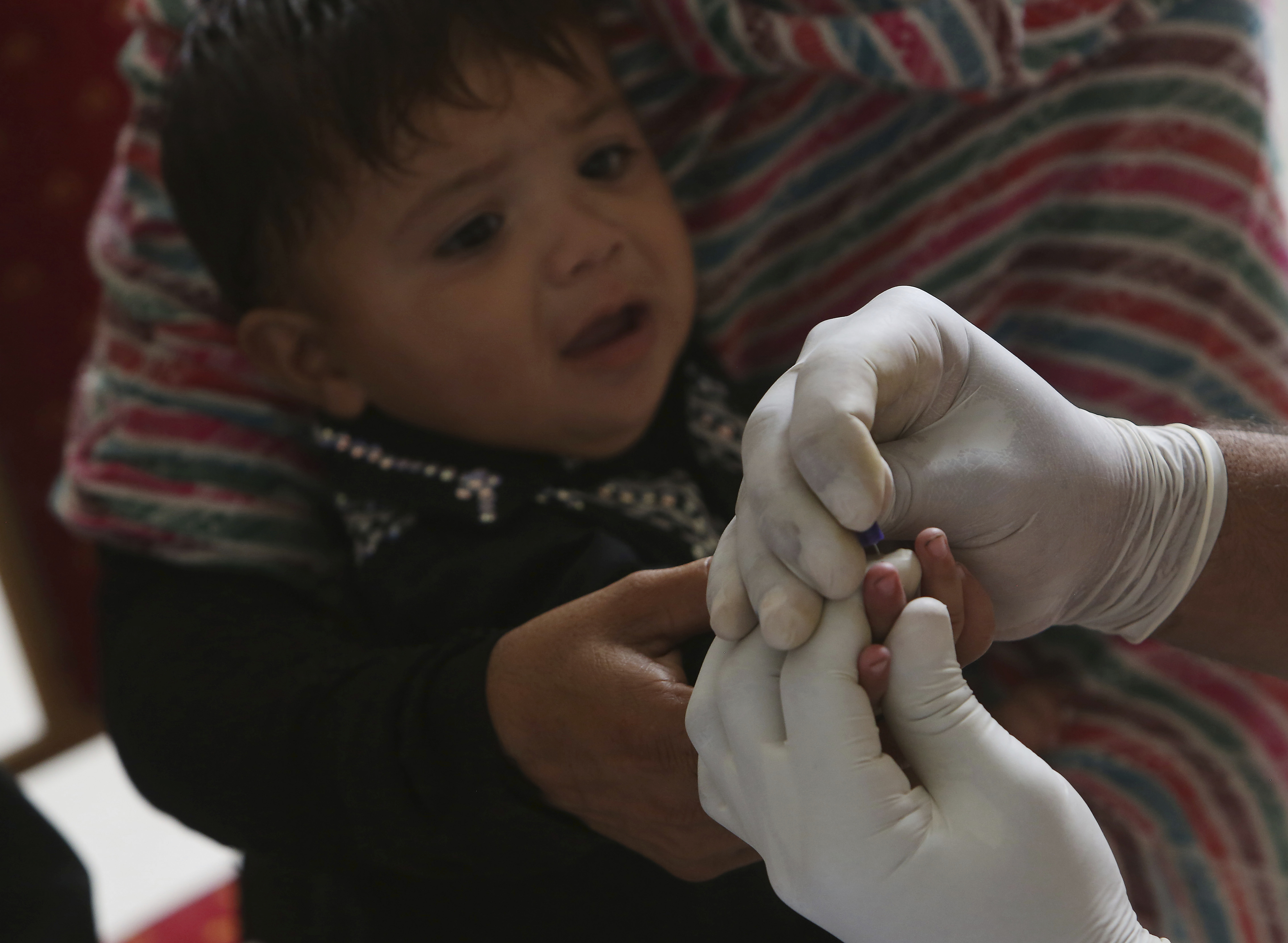 In this May 16, 2019 photo, A Pakistani doctor takes blood sample of a child during a screening camp in Ratodero, in southern province of Sindh in Pakistan. The worst HIV outbreak among children, many of them under 5 years old, occurred in Pakistan and a study released on Thursday, Dec. 19, blamed dirty needles and tainted blood but it also said the Pakistan government has to do more to understand how the virus went from high-risk groups like drug users and sex workers to the general population. (AP Photo/Fareed Khan)