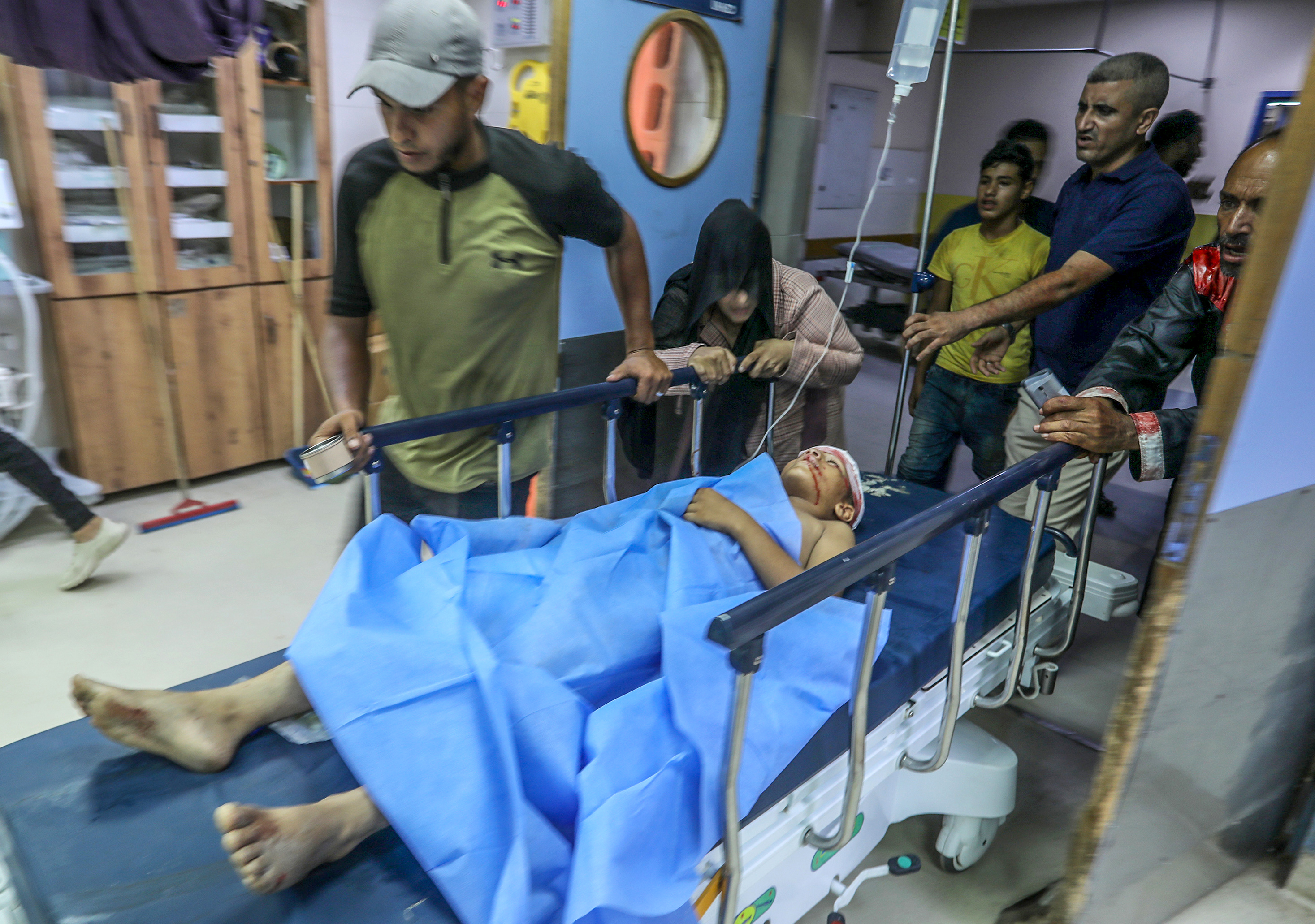 KHAN YUNIS, PALESTINE - AUGUST 12 : (EDITORS NOTE: Image depicts graphic content) An 11-year-old child, Khalid Shaat, who is severely injured after an Israeli drone attack, is brought to Nasser Hospital for medical treatment, as a child and an elderly man are wounded after the strike, on August 12, 2026 in Khan Yunis, Palestine. ( Abed Rahim Khatib - Anadolu Agency )