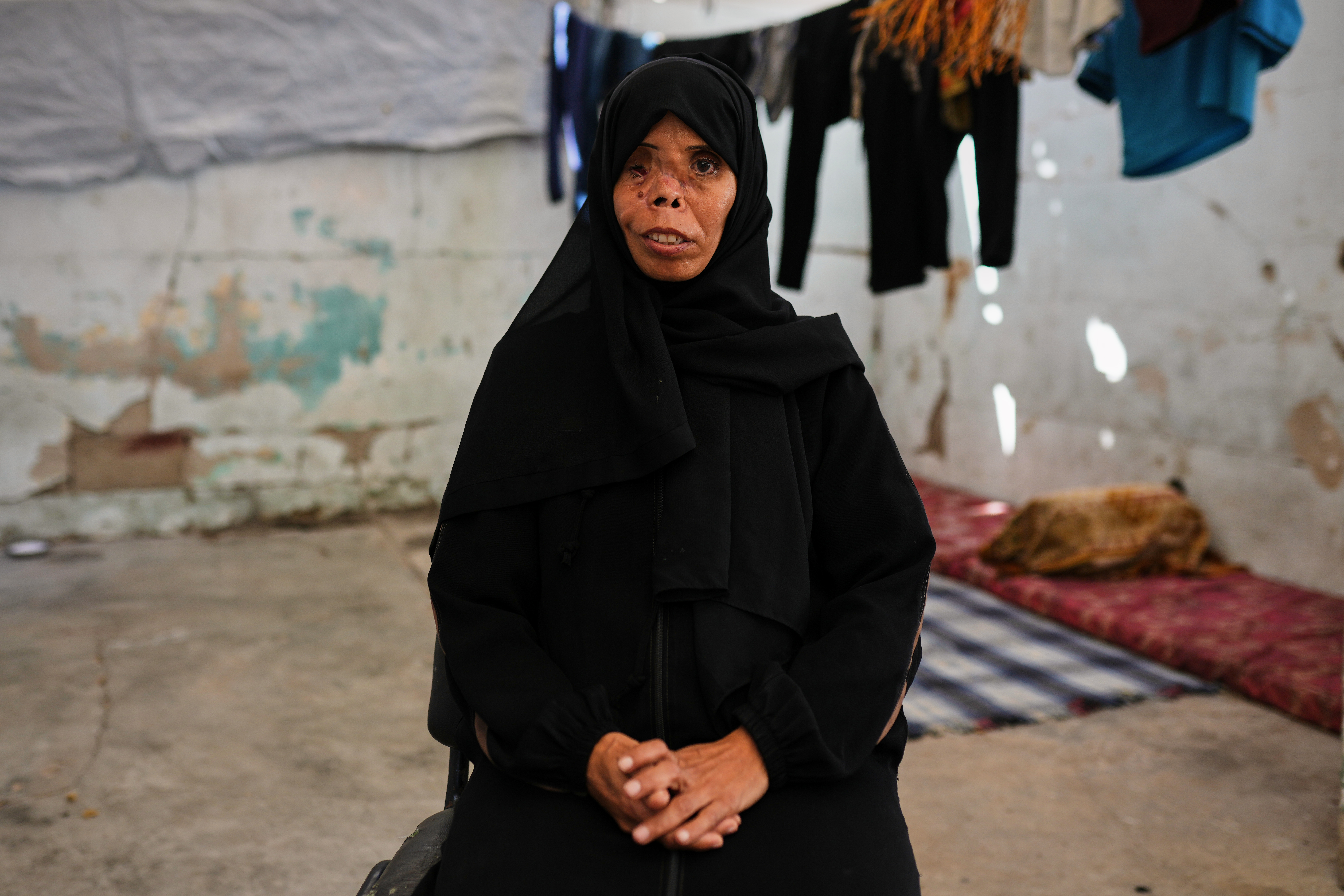 Tent cities expand in Gaza amid widespread destruction and loss